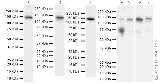 Western blot - Anti-Axl antibody [EPR21107] (ab215205), expandable thumbnail