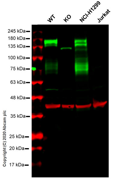 Western blot - Anti-Axl antibody [EPR21107] - BSA and Azide free (AB234258), expandable thumbnail