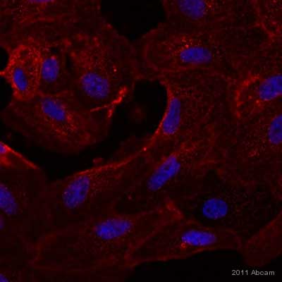 Immunocytochemistry/ Immunofluorescence - Anti-Axl antibody [MM0098-2N33] (AB89224)