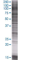 SDS-PAGE - Axl overexpression 293T lysate (whole cell) (AB94145)