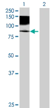 Western blot - Axl overexpression 293T lysate (whole cell) (AB94145)