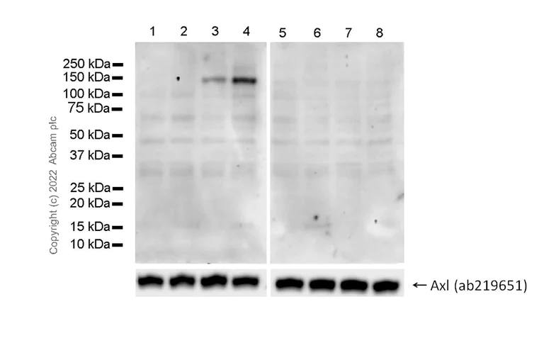 Western blot - Anti-AXL (phospho Y702) + MERTK (phospho Y753) + TYRO3 (phospho Y685) antibody [EPR26140-66] (AB302718)