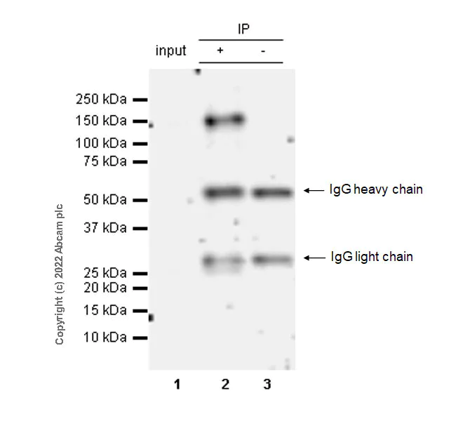 Immunoprecipitation - Anti-AXL (pY702) + MERTK (pY753) + TYRO3 (pY685) antibody [EPR26140-66] - BSA and Azide free (AB302719)