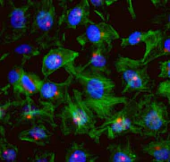 Immunocytochemistry/ Immunofluorescence - Anti-AZI1 antibody (AB84864)
