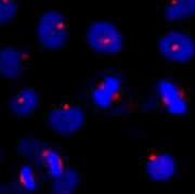Immunocytochemistry/ Immunofluorescence - Anti-AZI1 antibody (AB84864)