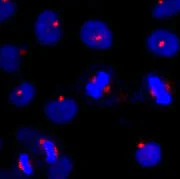 Immunocytochemistry/ Immunofluorescence - Anti-AZI1 antibody (AB84864)