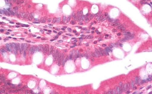 Immunohistochemistry (Formalin/PFA-fixed paraffin-embedded sections) - Anti-AZIN2 antibody (AB192771)