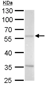 Western blot - Anti-AZIN2 antibody (AB192771)