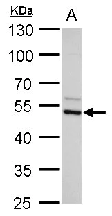 Western blot - Anti-AZIN2 antibody (AB192771)