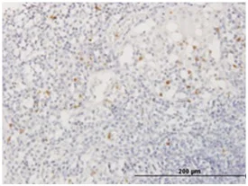 Immunohistochemistry (Formalin/PFA-fixed paraffin-embedded sections) - Anti-Azurocidin antibody (AB167336)