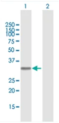 Western blot - Anti-Azurocidin antibody (AB167336)