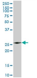 Western blot - Anti-Azurocidin antibody (AB167336)