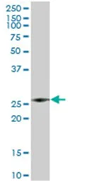 Western blot - Anti-Azurocidin antibody (AB167336)