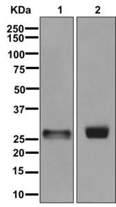 Western blot - Anti-Azurocidin antibody [EPR9502] (AB178678)