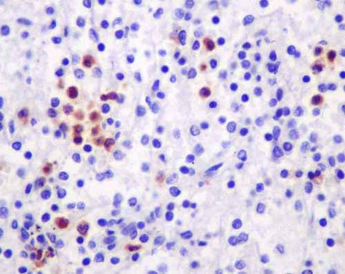 Immunohistochemistry (Formalin/PFA-fixed paraffin-embedded sections) - Anti-Azurocidin antibody [EPR9503] - BSA and Azide free (AB250556), expandable thumbnail