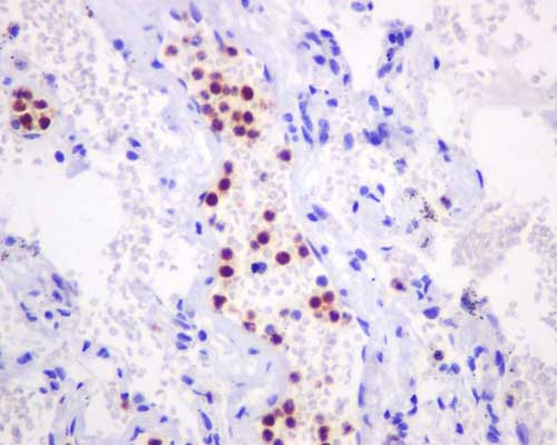 Immunohistochemistry (Formalin/PFA-fixed paraffin-embedded sections) - Anti-Azurocidin antibody [EPR9503] - BSA and Azide free (AB250556), expandable thumbnail