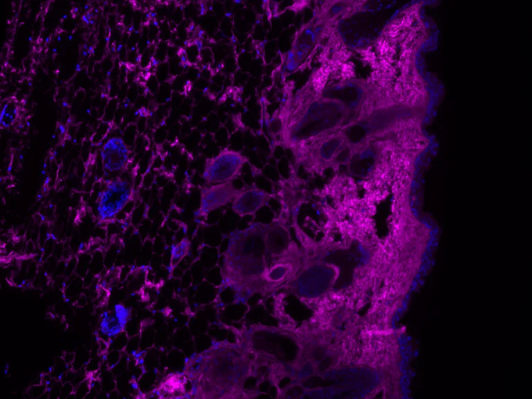 Immunofluorescence - B-CHP Collagen Hybridizing Peptide - Biotin Conjugate (AB325718)