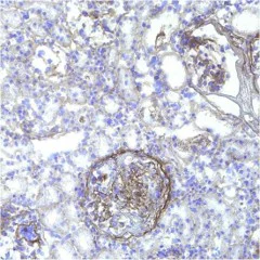 Immunohistochemistry (Formalin/PFA-fixed paraffin-embedded sections) - B-CHP Collagen Hybridizing Peptide - Biotin Conjugate (AB325718)