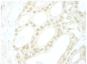 Immunohistochemistry (Formalin/PFA-fixed paraffin-embedded sections) - Anti-B MyB antibody (AB114055)