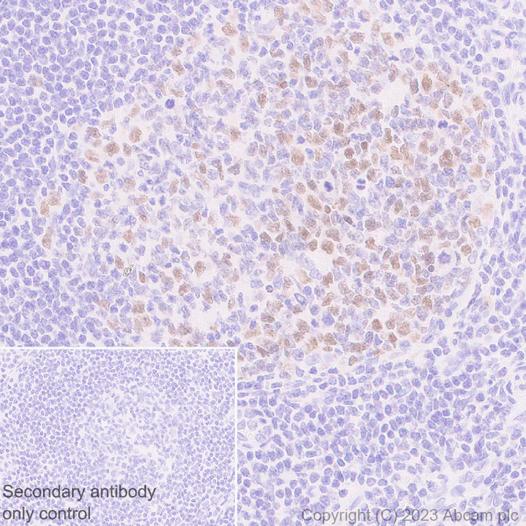 Immunohistochemistry (Formalin/PFA-fixed paraffin-embedded sections) - Anti-B MyB antibody [EPR26321-89] - BSA and Azide free (AB314863)