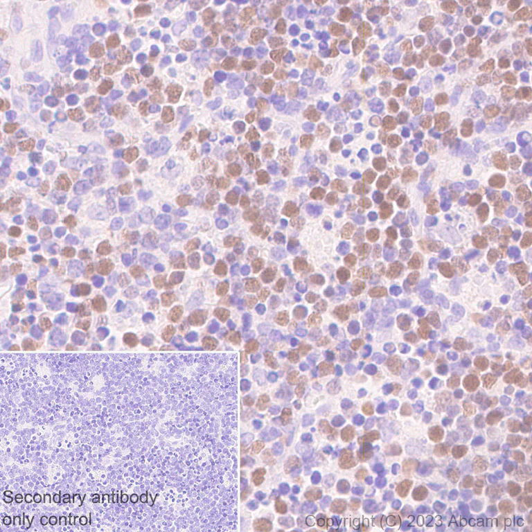 Immunohistochemistry (Formalin/PFA-fixed paraffin-embedded sections) - Anti-B MyB antibody [EPR26321-89] - BSA and Azide free (AB314863)