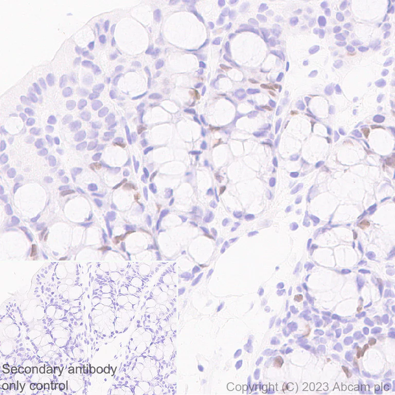 Immunohistochemistry (Formalin/PFA-fixed paraffin-embedded sections) - Anti-B MyB antibody [EPR26321-89] - BSA and Azide free (AB314863)