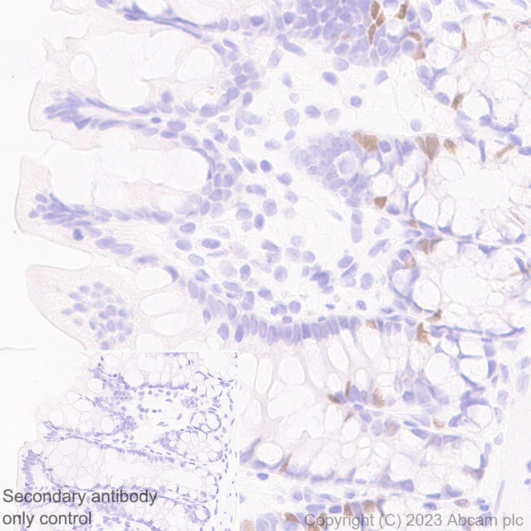 Immunohistochemistry (Formalin/PFA-fixed paraffin-embedded sections) - Anti-B MyB antibody [EPR26321-89] - BSA and Azide free (AB314863)
