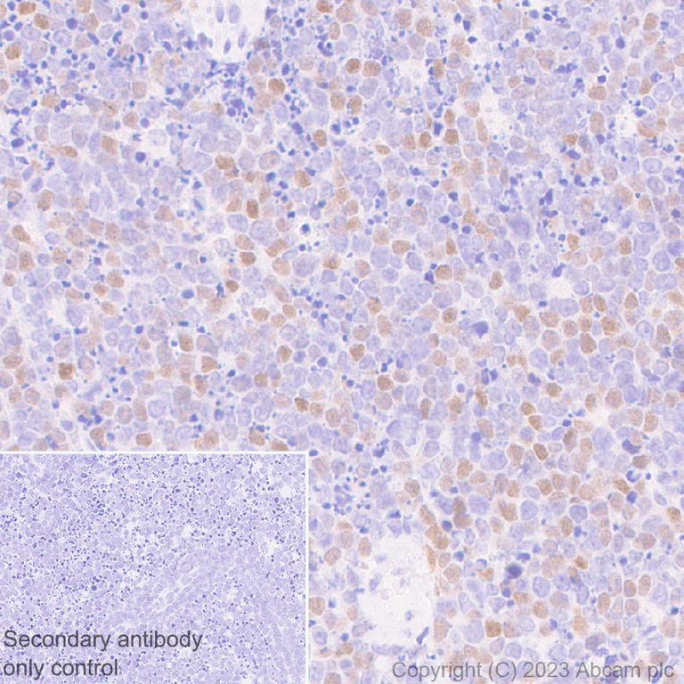 Immunohistochemistry (Formalin/PFA-fixed paraffin-embedded sections) - Anti-B MyB antibody [EPR26321-89] - BSA and Azide free (AB314863)