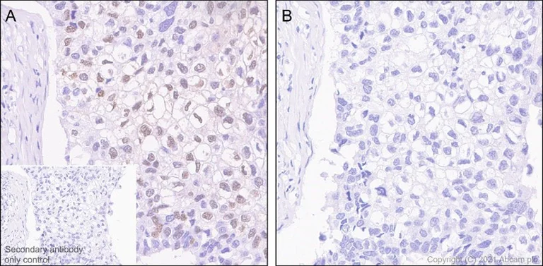 Immunohistochemistry (Formalin/PFA-fixed paraffin-embedded sections) - Anti-B MyB (phospho T487) antibody [EPR2204Y] (AB76009)
