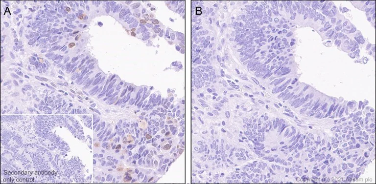 Immunohistochemistry (Formalin/PFA-fixed paraffin-embedded sections) - Anti-B MyB (phospho T487) antibody [EPR2204Y] (AB76009)