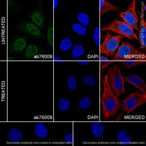Immunocytochemistry/ Immunofluorescence - Anti-B MyB (phospho T487) antibody [EPR2204Y] - BSA and Azide free (AB232521)