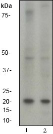 Western blot - Anti-b-Myc antibody [EP643Y] (AB40798)