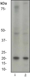 Western blot - Anti-b-Myc antibody [EP643Y] (AB40798)