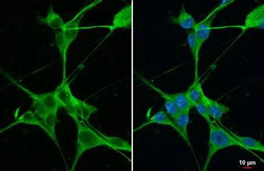 Immunocytochemistry/ Immunofluorescence - Anti-B-Raf antibody [HL1606] (AB308176)