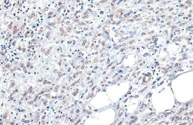 Immunohistochemistry paraffin embedded sections - Anti-B-Raf antibody [HL1606] (AB308176)