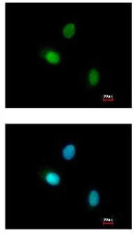 Immunocytochemistry/ Immunofluorescence - Anti-B19 antibody (AB137492)