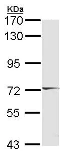 Western blot - Anti-B19 antibody (AB137492)