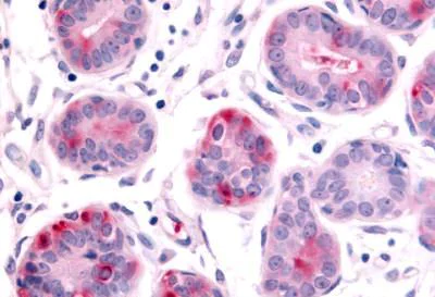 Immunohistochemistry (Formalin/PFA-fixed paraffin-embedded sections) - Anti-B19 antibody (AB189059)