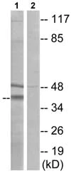 Western blot - Anti-B1R antibody (AB75148)