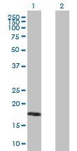 Western blot - Anti-B27 antibody (AB168120), expandable thumbnail