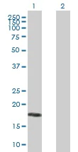 Western blot - Anti-B27 antibody (AB168120)