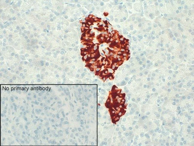 Immunohistochemistry (Formalin/PFA-fixed paraffin-embedded sections) - Anti-B2R antibody [13HCLC] (AB277806)
