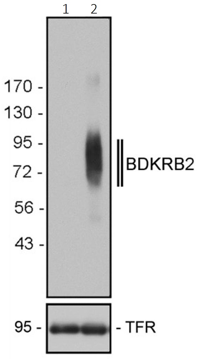 Western blot - Anti-B2R antibody [13HCLC] (AB277806), expandable thumbnail