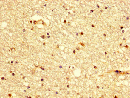 Immunohistochemistry (Formalin/PFA-fixed paraffin-embedded sections) - Anti-B2R antibody (AB236093)