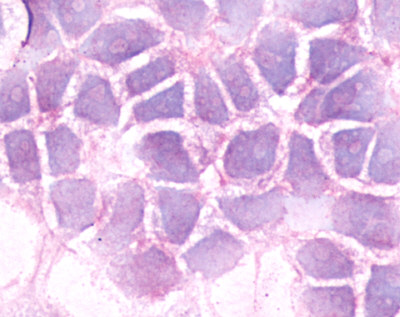Immunocytochemistry - Anti-B2R antibody - C-terminal (AB188797), expandable thumbnail