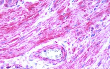 Immunohistochemistry (Formalin/PFA-fixed paraffin-embedded sections) - Anti-B2R antibody - C-terminal (AB188797), expandable thumbnail