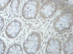 Immunohistochemistry (Formalin/PFA-fixed paraffin-embedded sections) - Anti-B3GALNT1 antibody (AB176891), expandable thumbnail