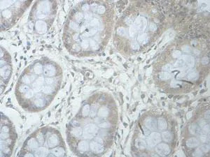 Immunohistochemistry (Formalin/PFA-fixed paraffin-embedded sections) - Anti-B3GALNT1 antibody (AB176891)