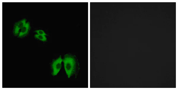 Immunocytochemistry/ Immunofluorescence - Anti-B3GALT2 antibody (AB177736)