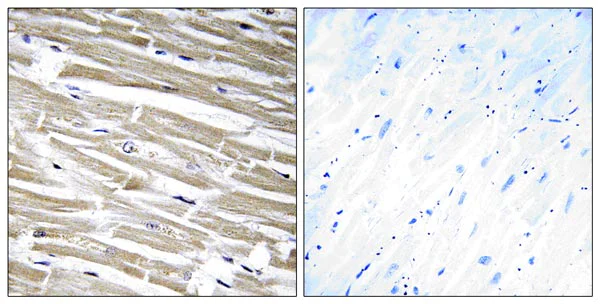 Immunohistochemistry (Formalin/PFA-fixed paraffin-embedded sections) - Anti-B3GALT2 antibody (AB177736)